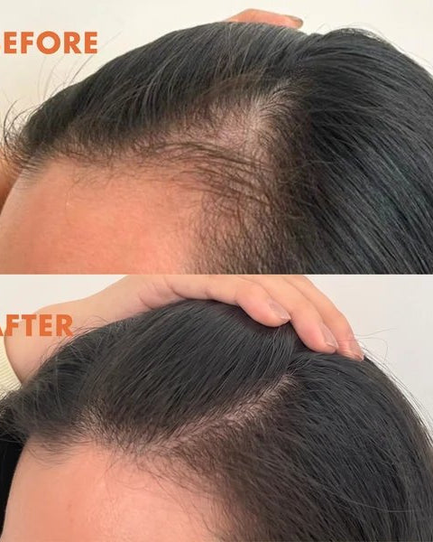 HANDMADE HEROES | Let It Thrive Hair Tonic