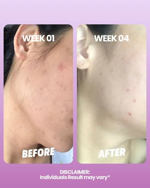 HANDMADE HEROES | The Ultimate Bakuchiol Booster Oil